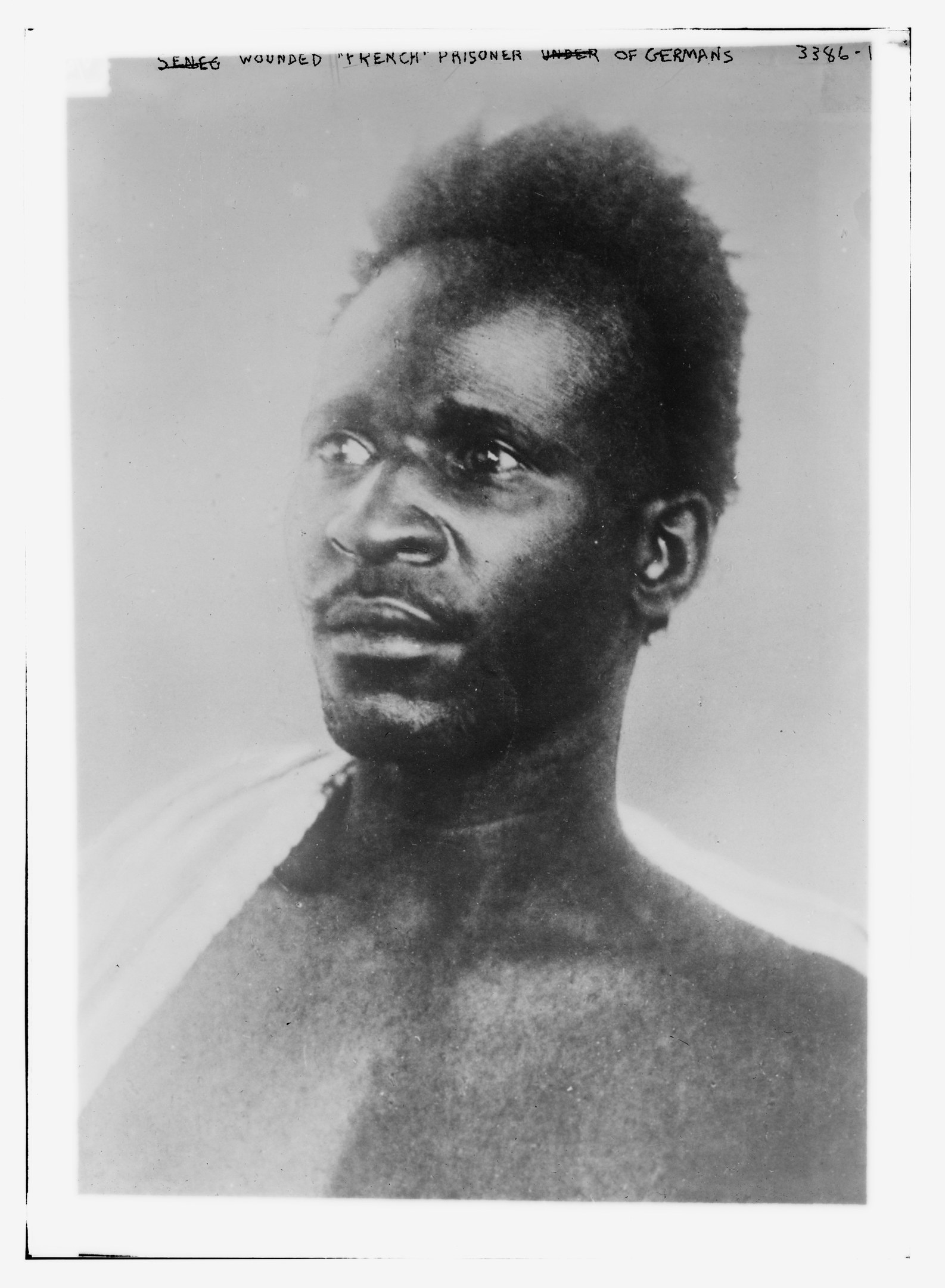 Schwarz-weiß-Foto eines Mannes mit ernstem Gesichtsausdruck, beschriftet mit 'Seneg Verwundeter französischer Gefangener unter Deutschen' oben.