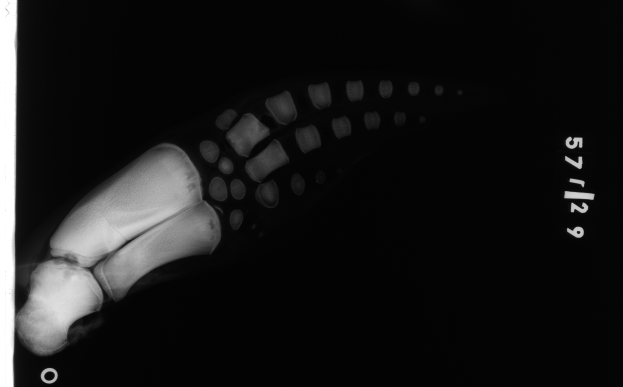 Ein Röntgenbild eines menschlichen Beins mit einem sichtbaren Bruch im Knächel, mit Text auf der rechten Seite gegen einen schwarzen Hintergrund.